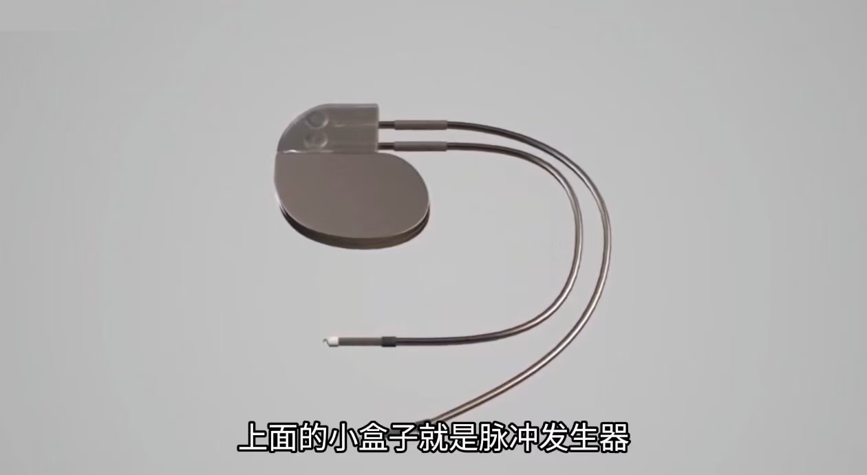 脉冲发生器